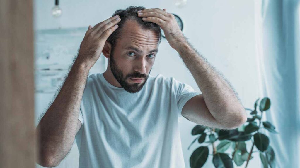 Soluzioni durature per coprire la calvizie ogni giorno